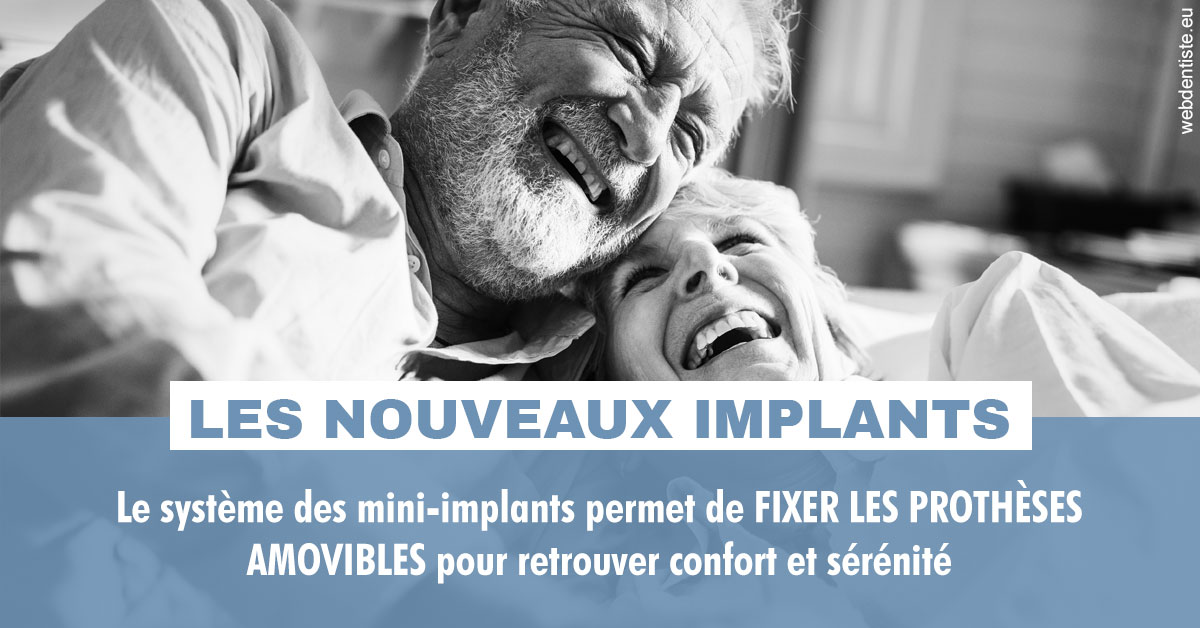 https://www.drbruneau.fr/Les nouveaux implants 2