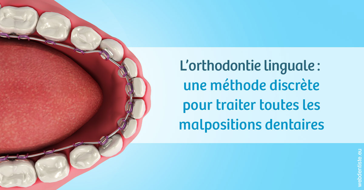 https://www.drbruneau.fr/L'orthodontie linguale 1