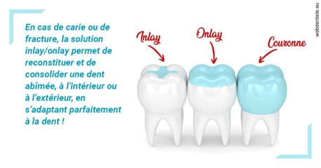 https://www.drbruneau.fr/L'INLAY ou l'ONLAY