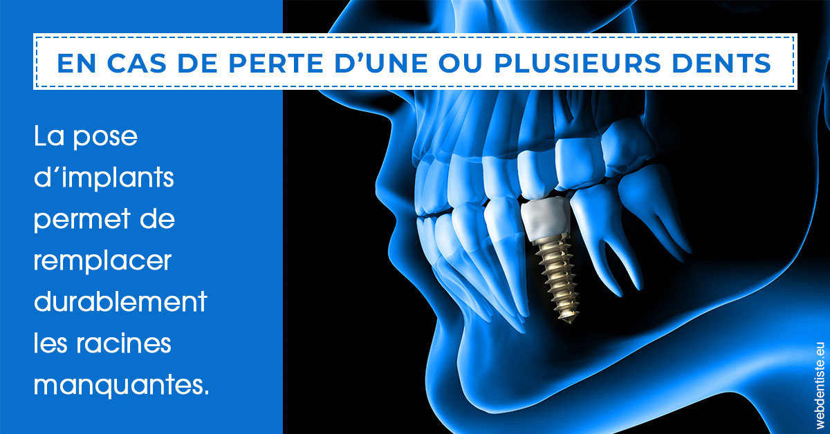https://www.drbruneau.fr/2024 T1 - Implants 01