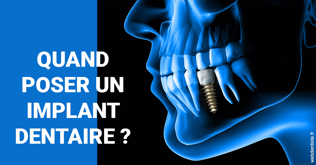 https://www.drbruneau.fr/Les implants 1