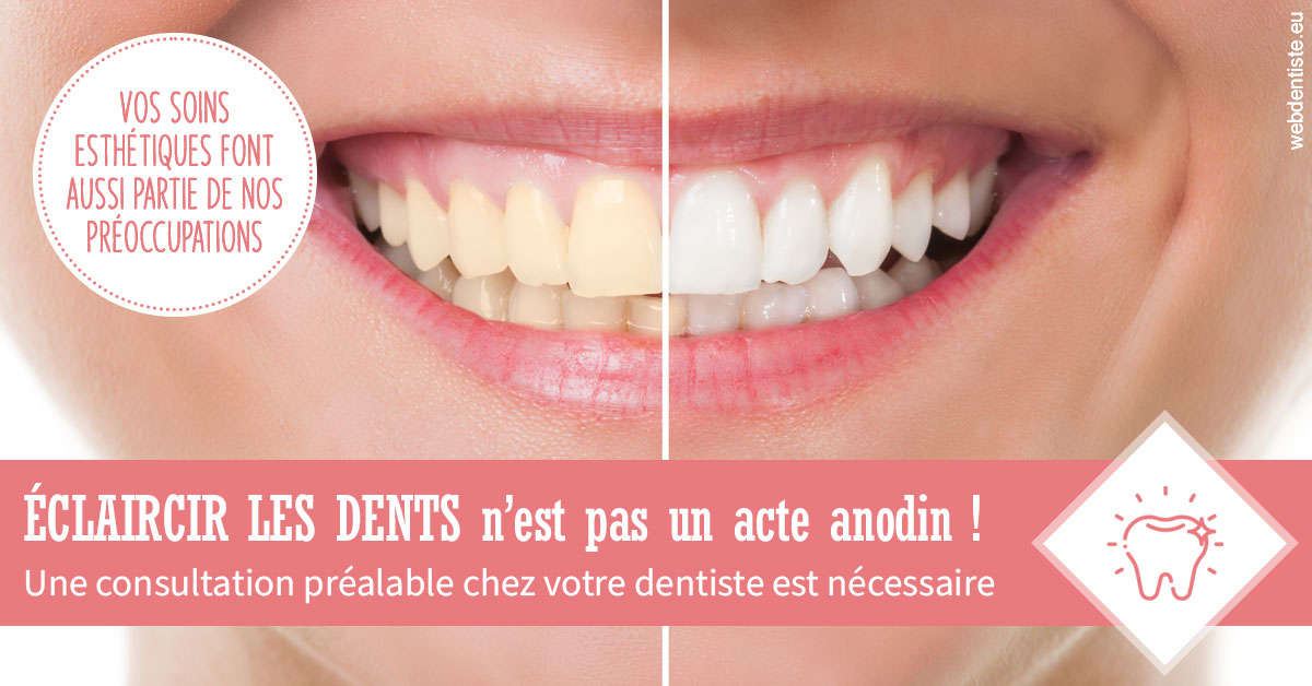 https://www.drbruneau.fr/Eclaircir les dents 1