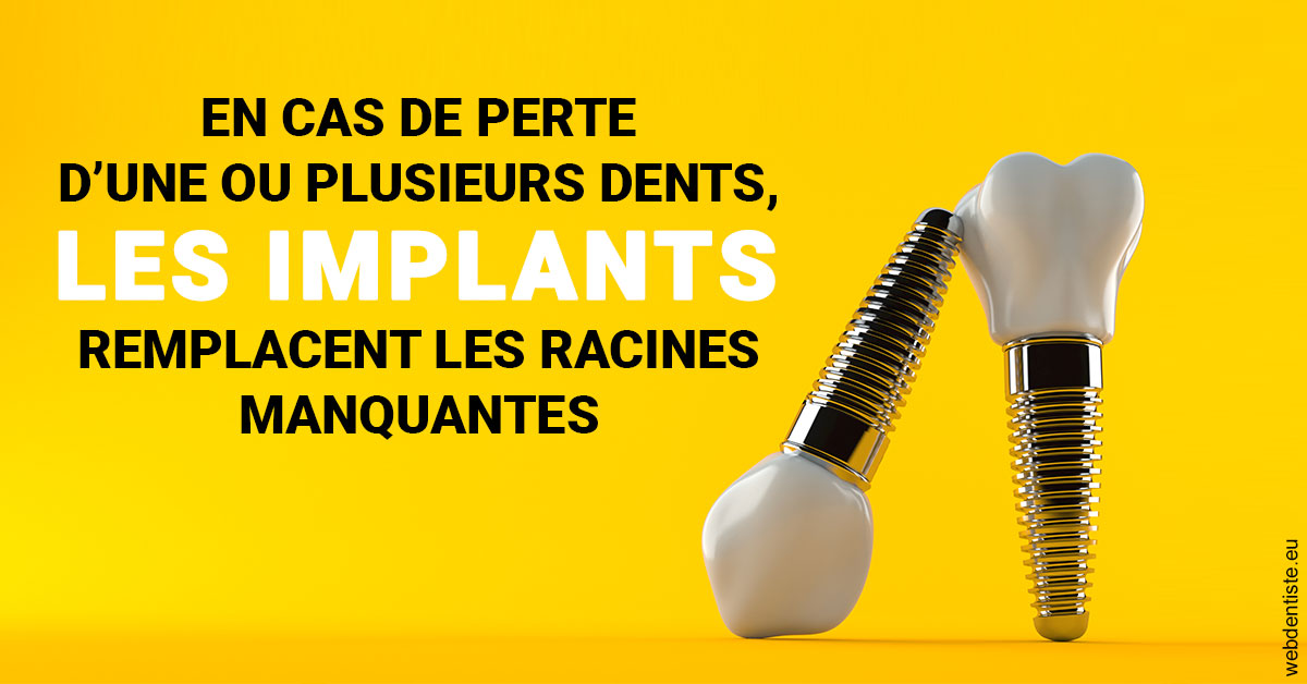 https://www.drbruneau.fr/Les implants 2