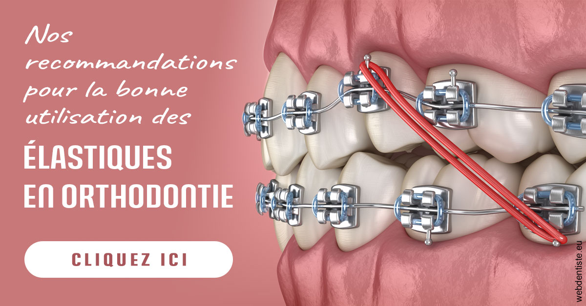 https://www.drbruneau.fr/Elastiques orthodontie 2